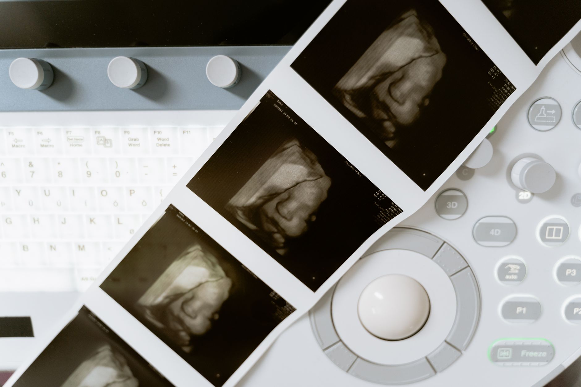 Finding Cheap 3D Scanners: Reddit's Top Picks & Budget Buys